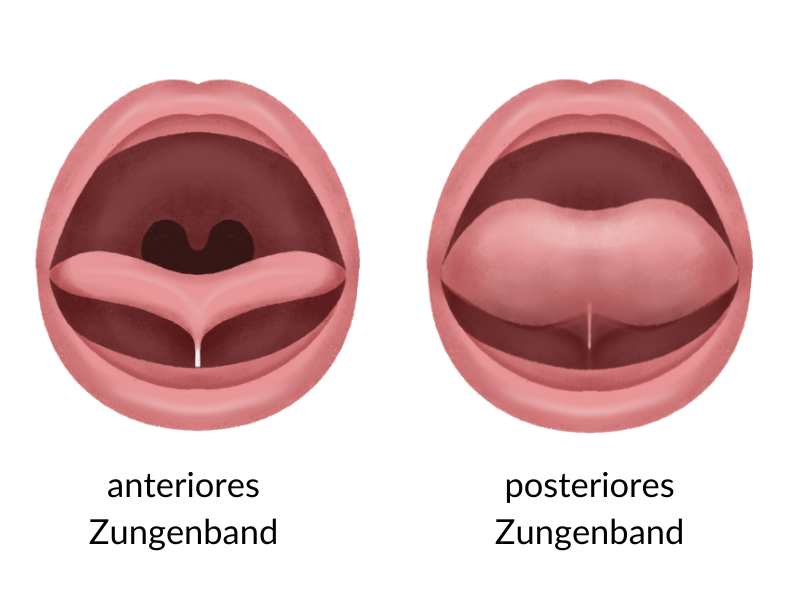 Anteriores und Posteriores Zungenband