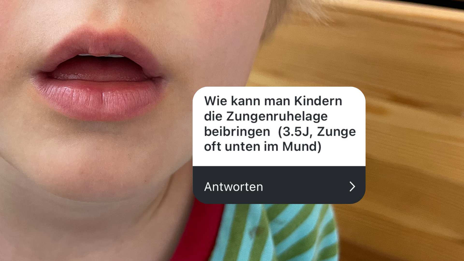 Was ist die Zungenruhelage und wie kann ich sie Kindern beibringen?